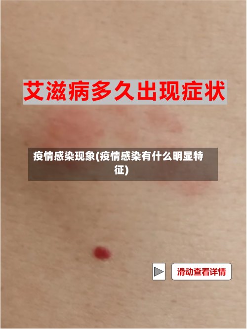 疫情感染现象(疫情感染有什么明显特征)