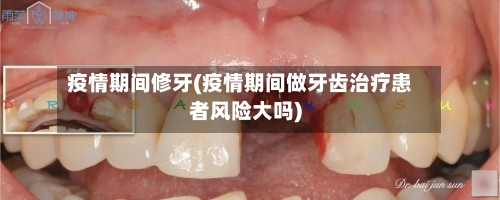 疫情期间修牙(疫情期间做牙齿治疗患者风险大吗)