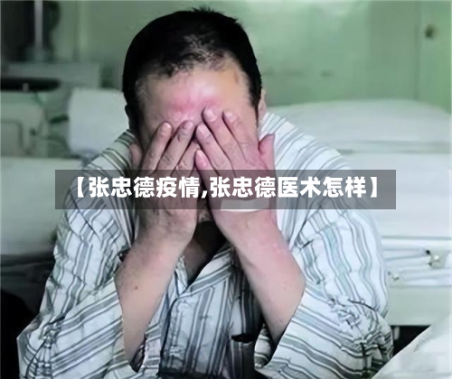 【张忠德疫情,张忠德医术怎样】