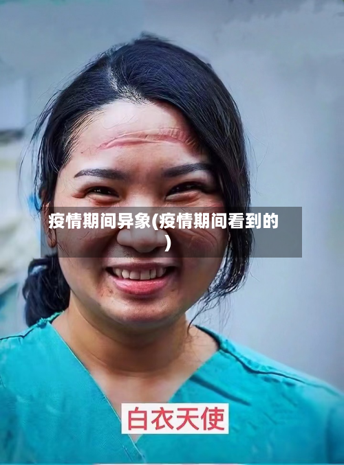 疫情期间异象(疫情期间看到的)