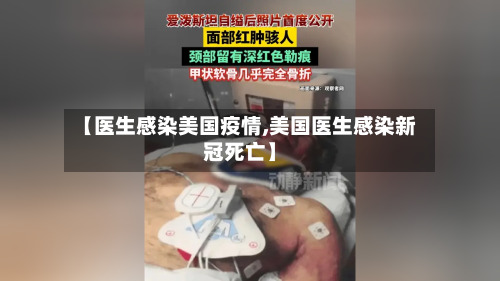 【医生感染美国疫情,美国医生感染新冠死亡】-第3张图片