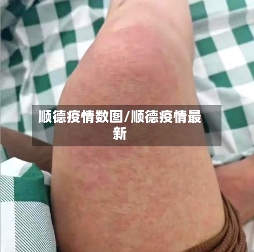 顺德疫情数图/顺德疫情最新