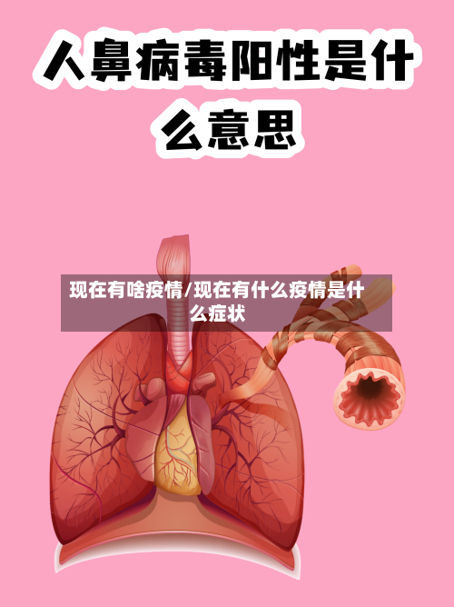 现在有啥疫情/现在有什么疫情是什么症状-第2张图片